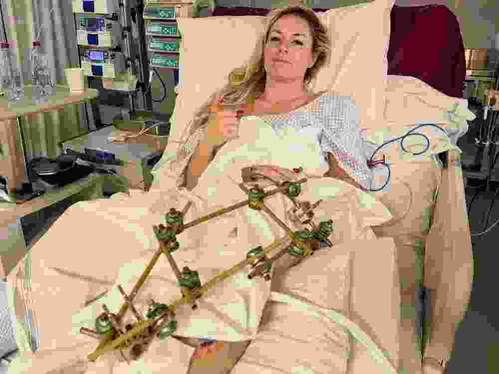 U.S. Olympic skier Lindsey Vonn shared a picture from the hospital following surgery.