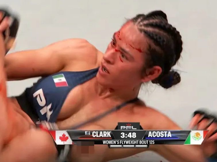 Screenshot of MMA fight between Shannon Clark and Lucero Acosta, where Acosta's left breast is exposed.